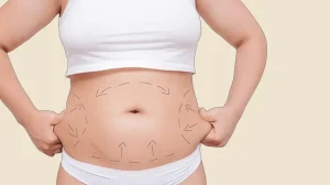 ابدومینوپلاستی